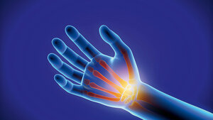 Grafik einer durchleuchteten Hand mit Hervorhebung der Handgelenkknochen