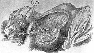 Kennen Sie William Steward Halsted?