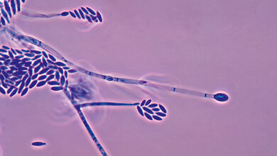 Schimmelpilze (Teil 4): Fusarium
