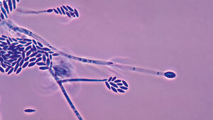 Schimmelpilze (Teil 4): Fusarium