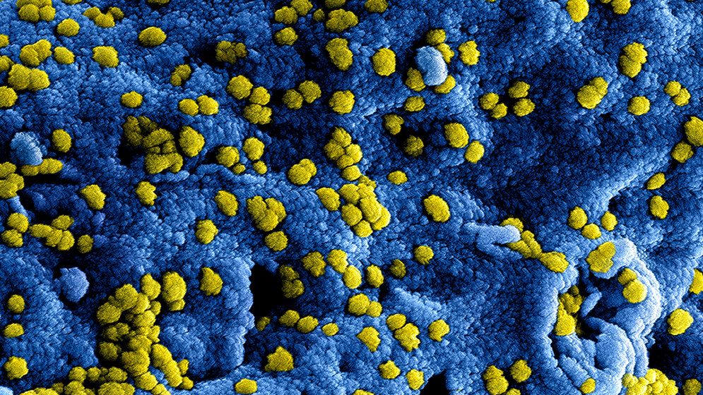 Abb8_MERS.jpg 57 epidemische Ausbrüche von MERS