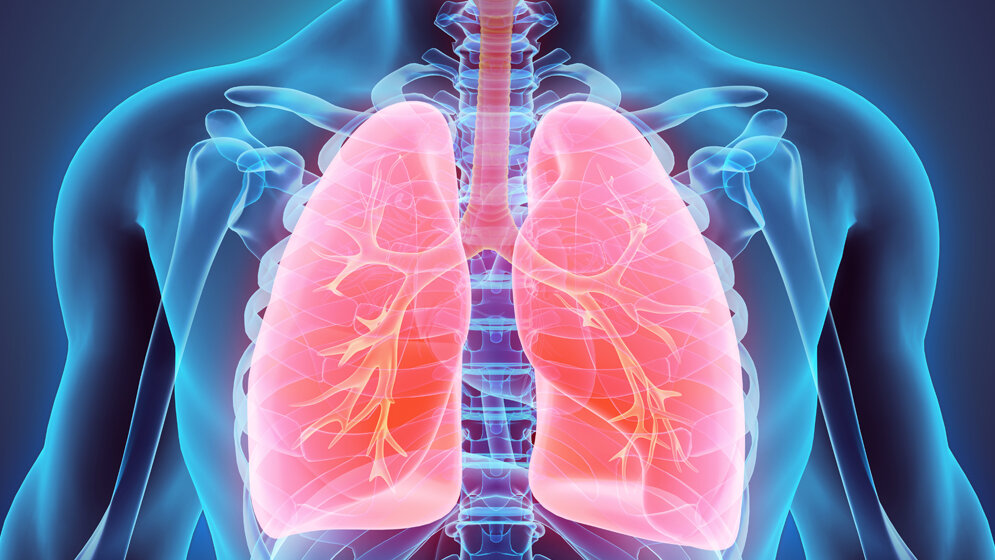Tumor-DNA im Blut zeigt Fortschreiten von Lungenkrebs frühzeitig an