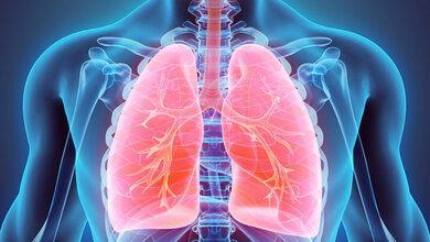 Tumor-DNA im Blut zeigt Fortschreiten von Lungenkrebs frühzeitig an