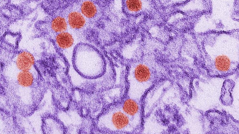 Zika_CDC_Cynthia_Goldsmith_13052016.jpg Zika-Viruspartikel