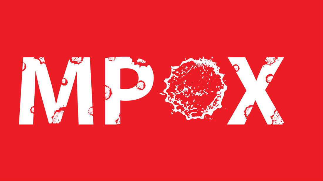 Roter Hintergrund mit dem weißen Schriftzug 'MPOX', Buchstaben mit fleckigen, zerstörten Texturen.