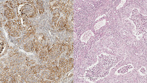 Optimierung und Validierung von PD-L1-Färbeprotokollen am Beispiel E1L3N (Teil 3)