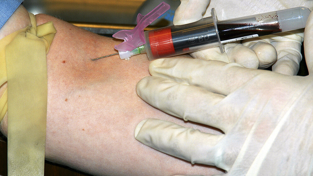 Eine qualitative Studie zu alltäglichen Fehlerquellen in der Präanalytik