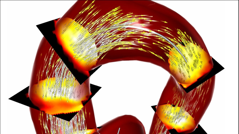 Analyse der Blutflussgeschwindigkeiten 