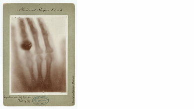 Frauen in der Radiologie