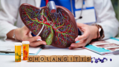 Modell einer Leber mit Gallenblase und Schrift mit Cholangitis.