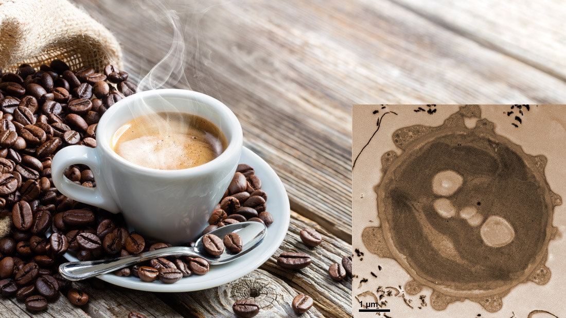 Tasse mit Espresso und Kaffeebohnen sowie das Bild einer Alge mit Kaffee als Kontrastmittel.