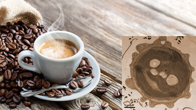 Tasse mit Espresso und Kaffeebohnen sowie das Bild einer Alge mit Kaffee als Kontrastmittel.