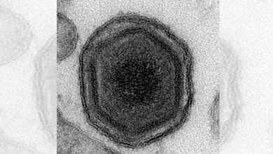 Virion des Afrikanischen Schweinepestvirus