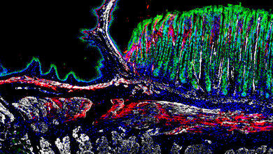 Gewebeschnitt aus dem gastroösophagealen Übergang einer Maus