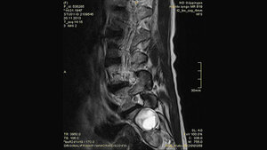 Schnittbilddiagnostik der Wirbelsäule (4.16)