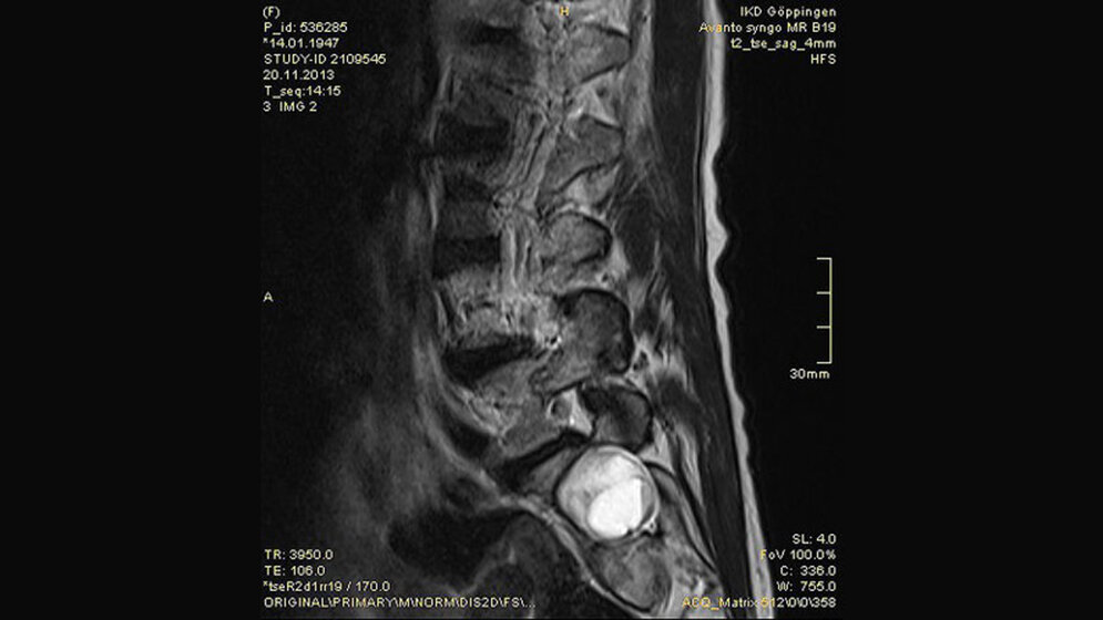 Schnittbilddiagnostik der Wirbelsäule (4.16)