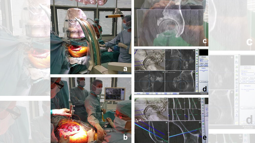 Dreidimensionale Röntgenbildgebung 