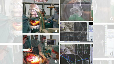 Dreidimensionale Röntgenbildgebung 
