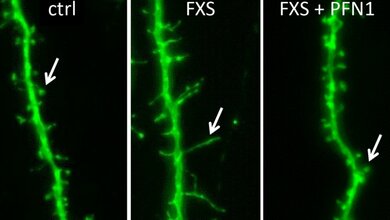 Nervenzellfortsaetze_Kontroll_Maus_TU_Braunschweig_09032016.jpg Nervenzellfortsätze (Dendriten)