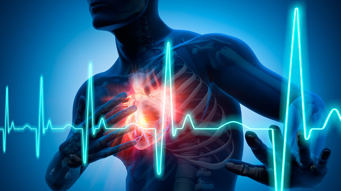 Schwere_Herzschwaeche.jpg Schwere_Herzschwaeche.jpg