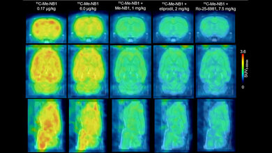 11C‐Me‐NB1 PET-Bilder 