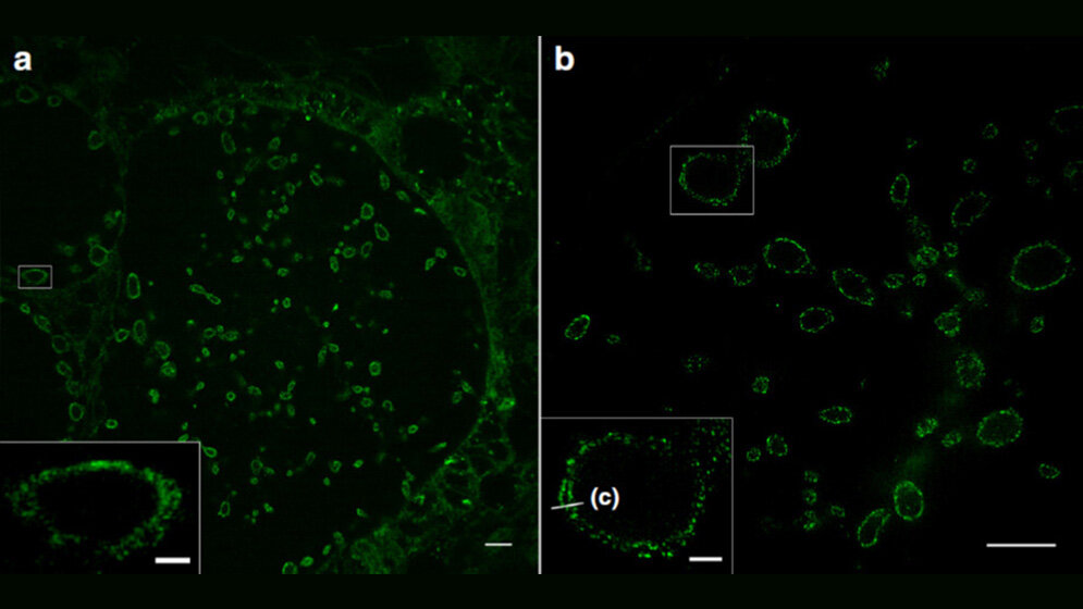 Sphingolipid-Expansionsmikroskopie (ExM) 