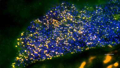 Staphylococcus aureus-Biofilm 
