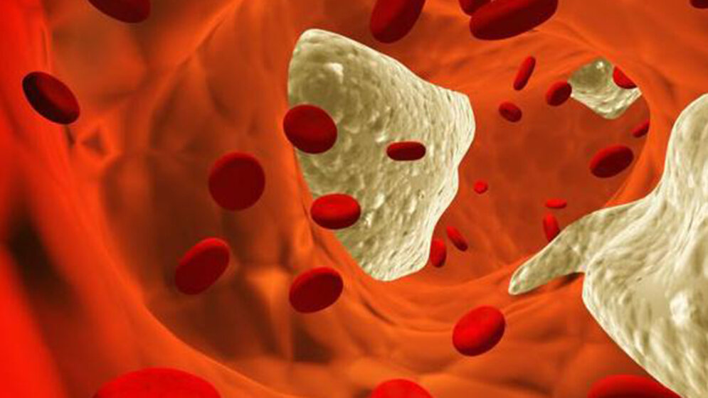 Angiologie Funktionsdiagnostik