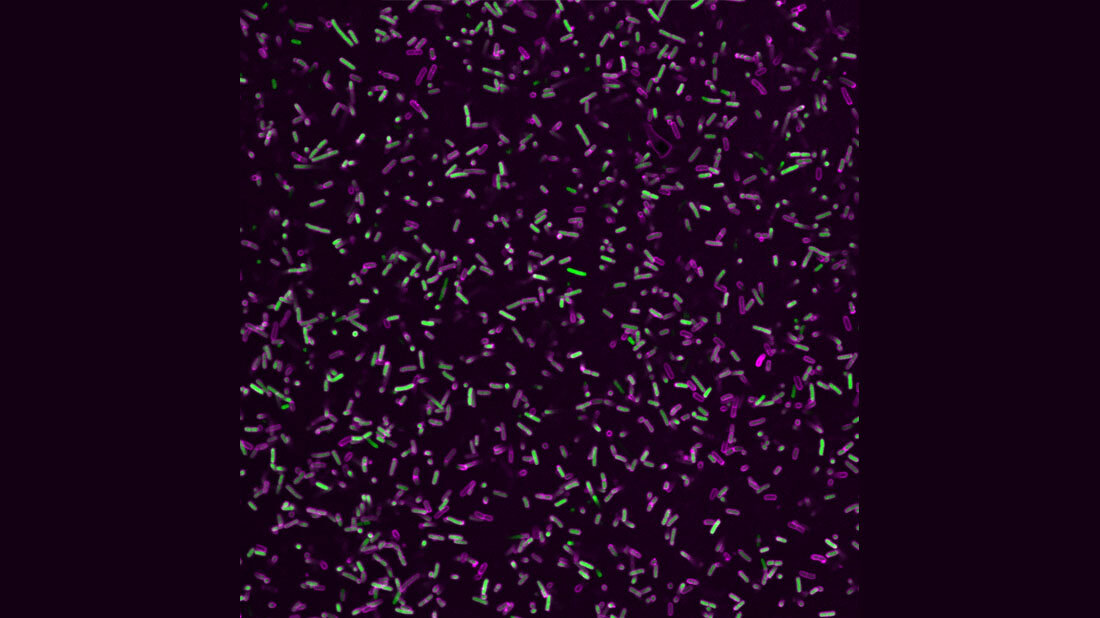 Gram-negative bakterielle Krankheitserreger (grün) umgeben von einem Proteinmantel aus GBP1-Proteinen (magenta).