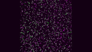 Gram-negative bakterielle Krankheitserreger (grün) umgeben von einem Proteinmantel aus GBP1-Proteinen (magenta).