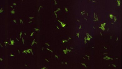 Legionella_pneumophila_CDC_Dr_William_Cherry_21042016.jpg Legionella pneumophila