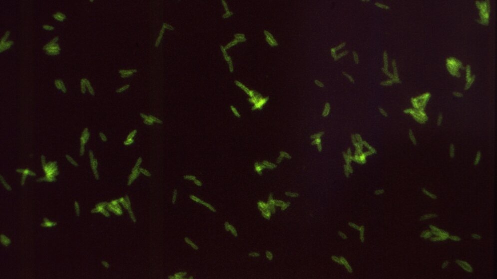 Legionella pneumophila