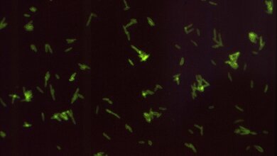 Legionella pneumophila