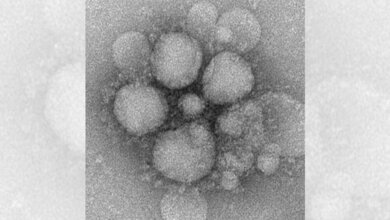 MERS_CoV_CDC.jpg MERS