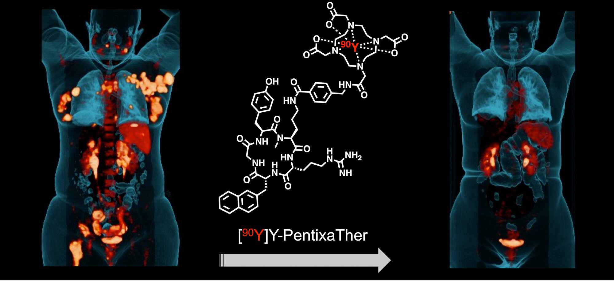 Einsatz von Radioliganden in der Bildgebung und Tumortherapie