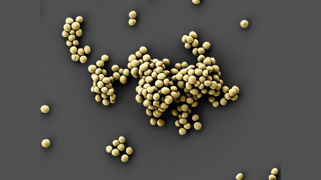 Staphylococcus epidermidis