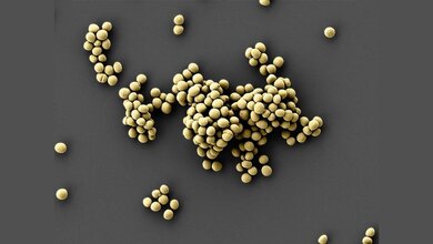 Staphylococcus_epidermidis.jpg Staphylococcus epidermidis