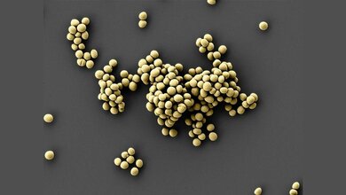 Staphylococcus epidermidis