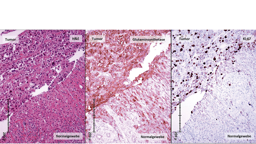 Das Beziehungsmuster zwischen der Leber und den Laborwerten
