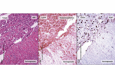 Das Beziehungsmuster zwischen der Leber und den Laborwerten