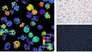 Amyloidbildende Zellen