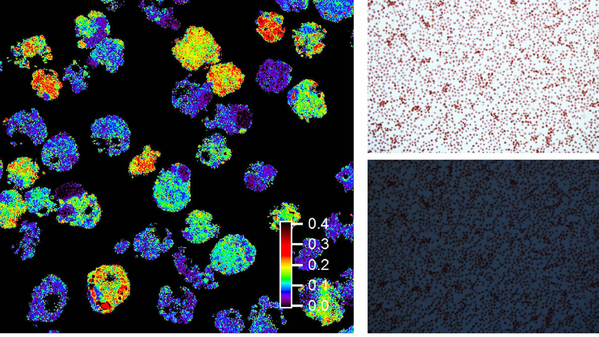 Amyloidbildende Zellen
