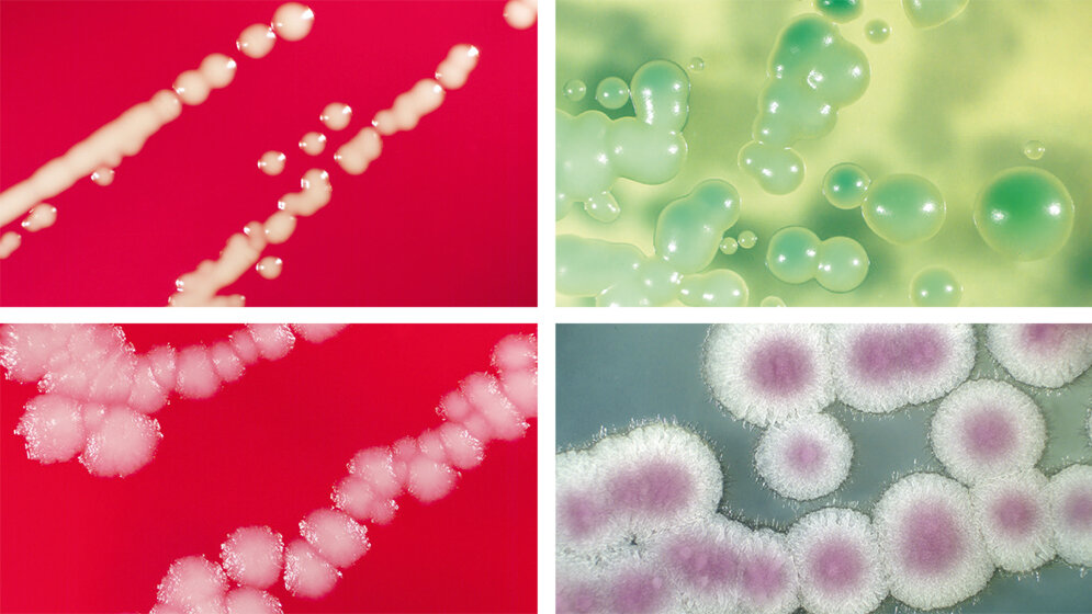 Die Rolle der Sprosspilze in der Medizin (Teil II)