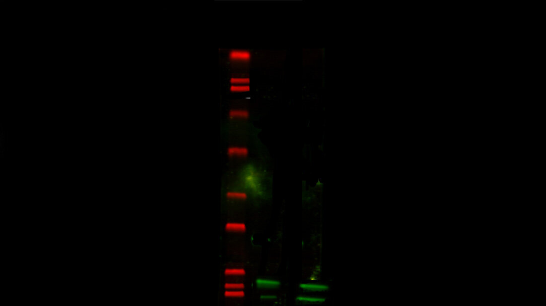 Titelbild zum Repetitorium zu immunologischen Verfahren: Western Blot