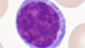 Typische Lymphozyten. BB Papp. Standardlymphozyt