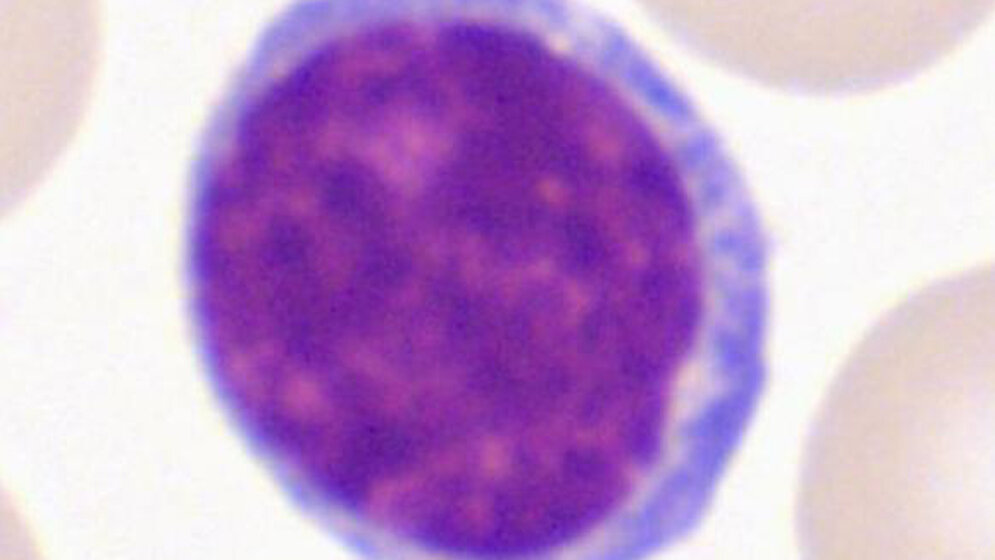 Typische Lymphozyten. BB Papp. Standardlymphozyt