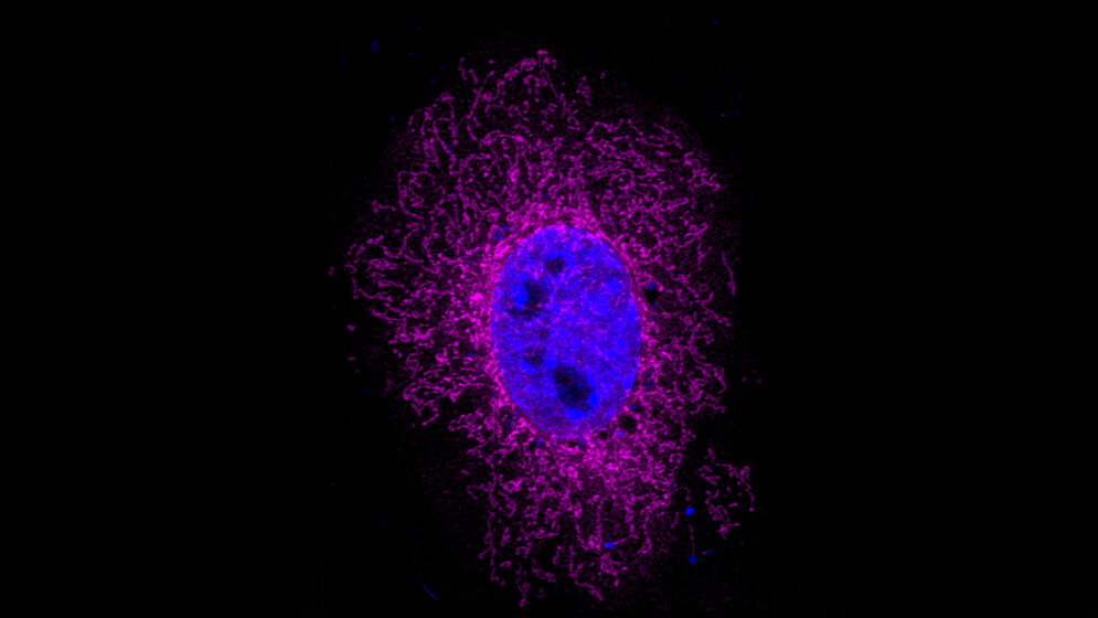 ARHGAP11B_Protein_Magenta_Namba_et_al_MPI_CBG.jpg ARHGAP11B-Protein