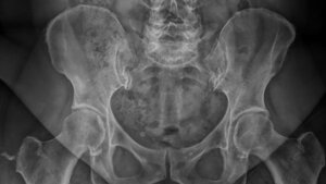 Anomalien und Normvarianten