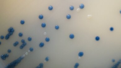 MRSA