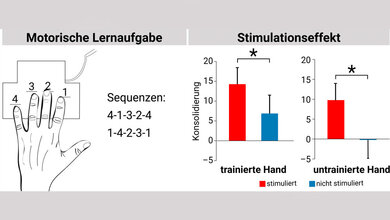 Stimulation_des_Gehirns_MPI_CBS_Jost_Julian_Rumpf.jpg Stimulation hilft